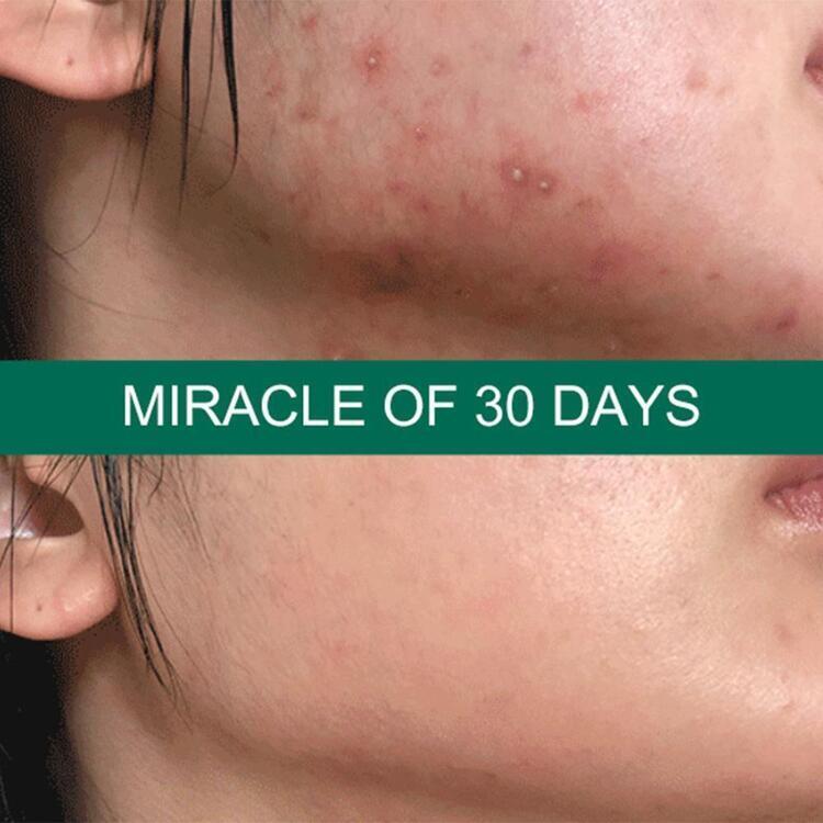 Сыворотка для лица Some By Mi AHA BHA PHA 30 Days Miracle Serum